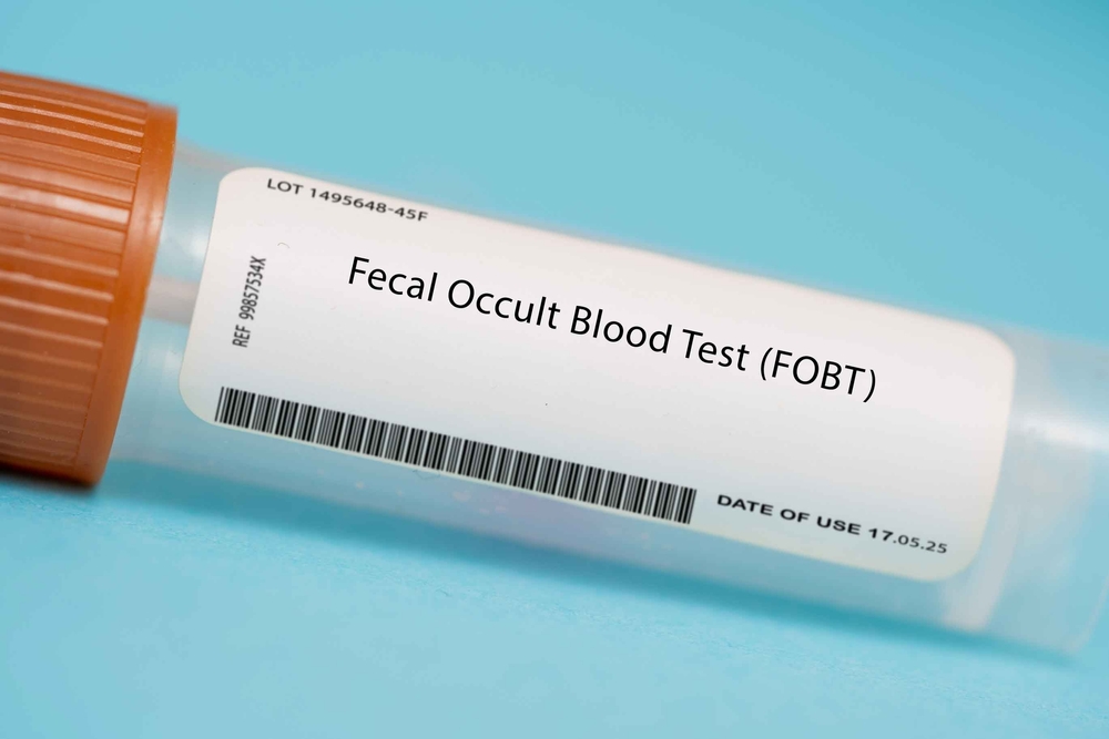 fecal occult blood test matters